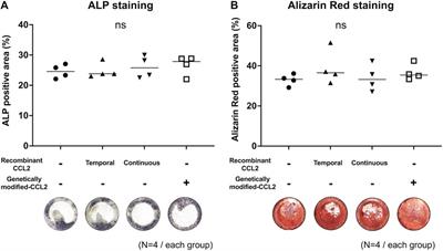 CCL2 promotes osteogenesis by facilitating macrophage migration during acute inflammation